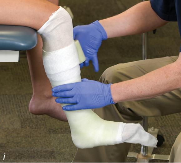 Athletic Taping, Bracing, and Casting- Human Kinetics