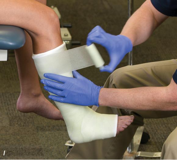 Athletic Taping, Bracing, and Casting- Human Kinetics